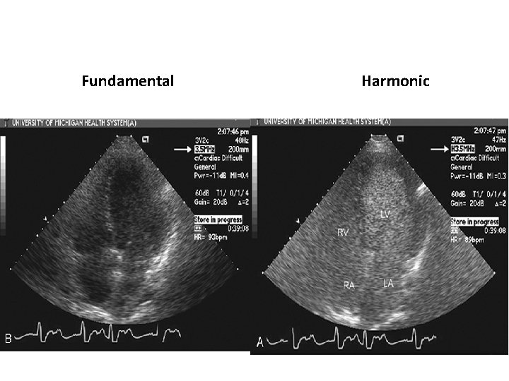 Fundamental Harmonic 