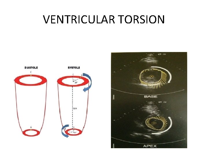 VENTRICULAR TORSION 