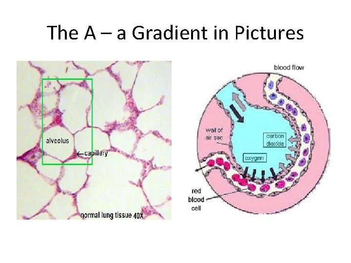 The A – a Gradient in Pictures 