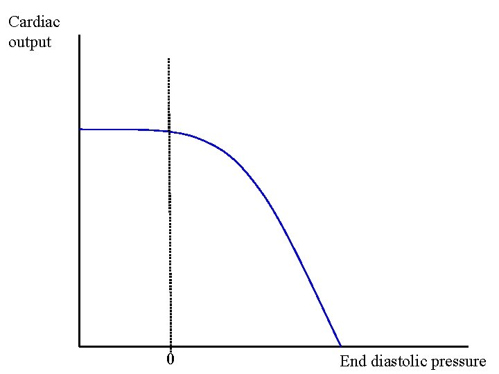 Cardiac output 0 End diastolic pressure 