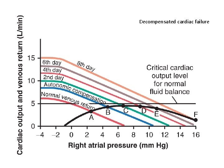 Decompensated cardiac failure 