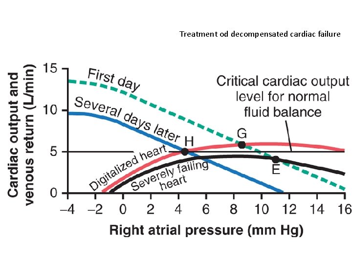 Treatment od decompensated cardiac failure 