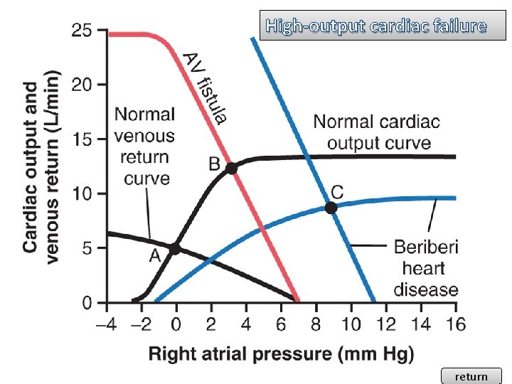 High-output cardiac failure return 