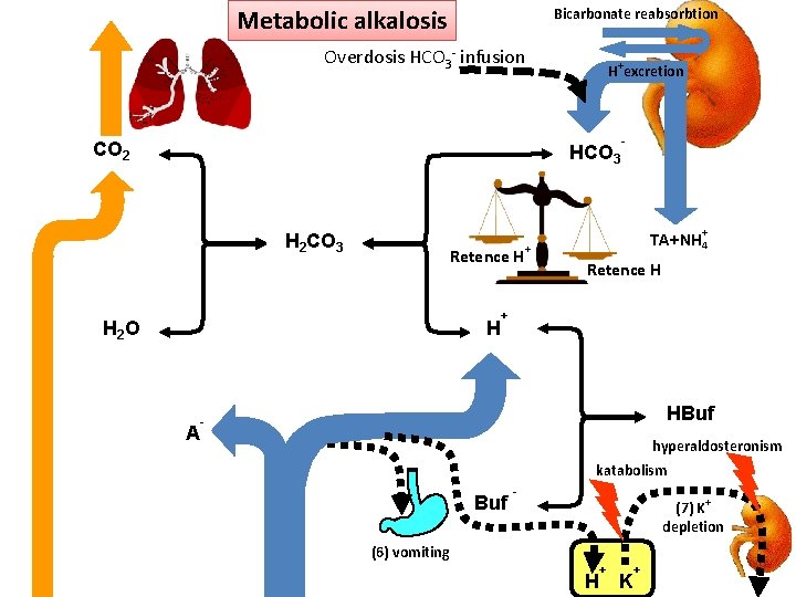 Metabolic alkalosis Bicarbonate reabsorbtion Overdosis HCO 3 - infusion CO 2 H+excretion HCO 3