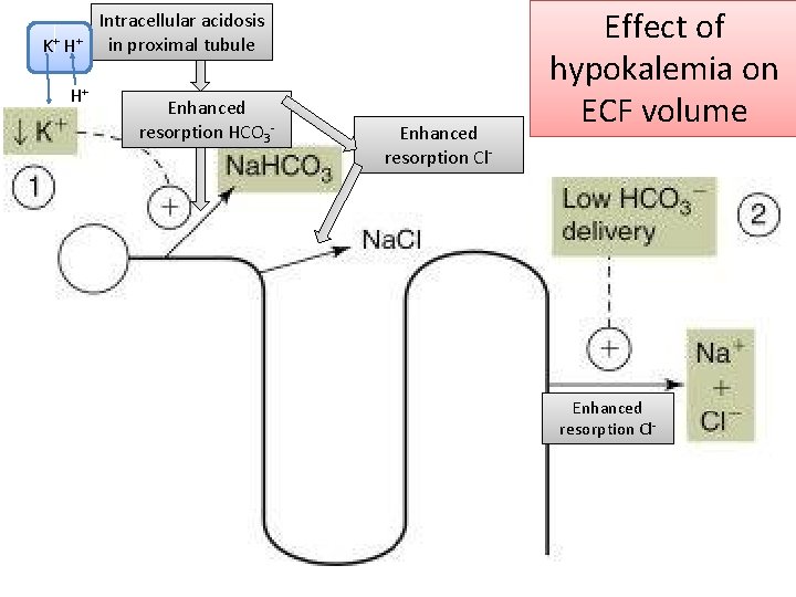 K + H+ H+ Intracellular acidosis in proximal tubule Enhanced resorption HCO 3 -