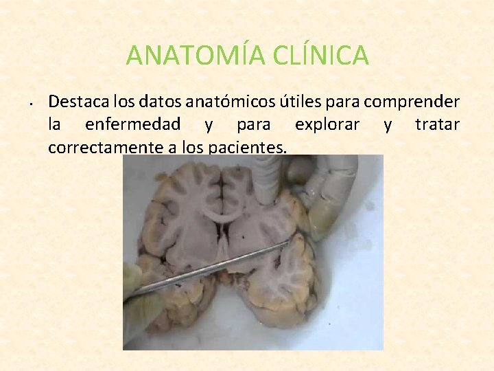 ANATOMÍA CLÍNICA • Destaca los datos anatómicos útiles para comprender la enfermedad y para