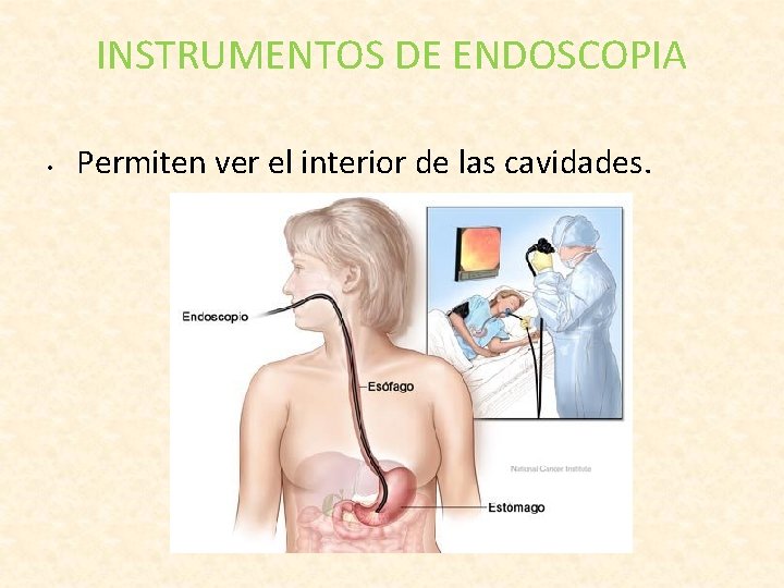 INSTRUMENTOS DE ENDOSCOPIA • Permiten ver el interior de las cavidades. 