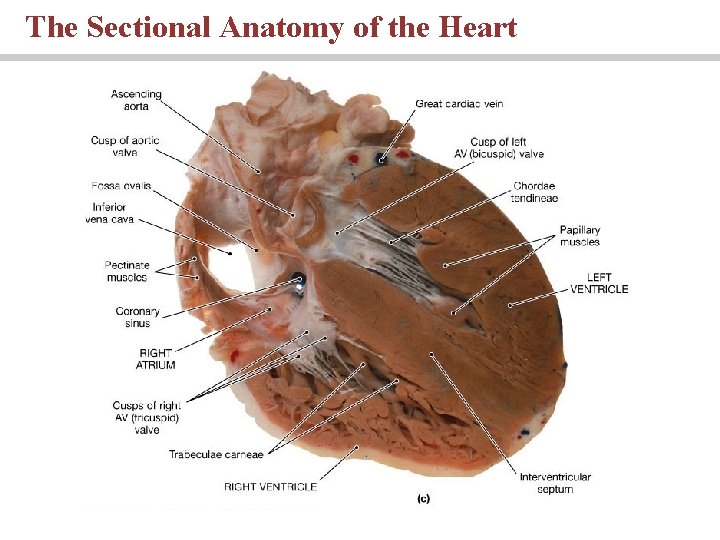 The Sectional Anatomy of the Heart 