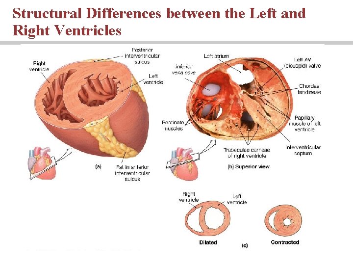 Structural Differences between the Left and Right Ventricles 