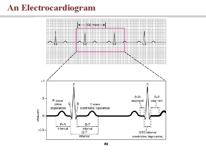 An Electrocardiogram 