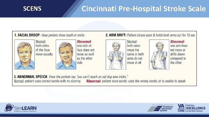 SCENS Cincinnati Pre-Hospital Stroke Scale 