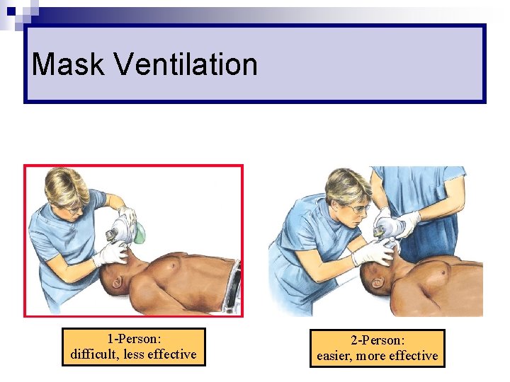 Mask Ventilation 1 -Person: difficult, less effective 2 -Person: easier, more effective 