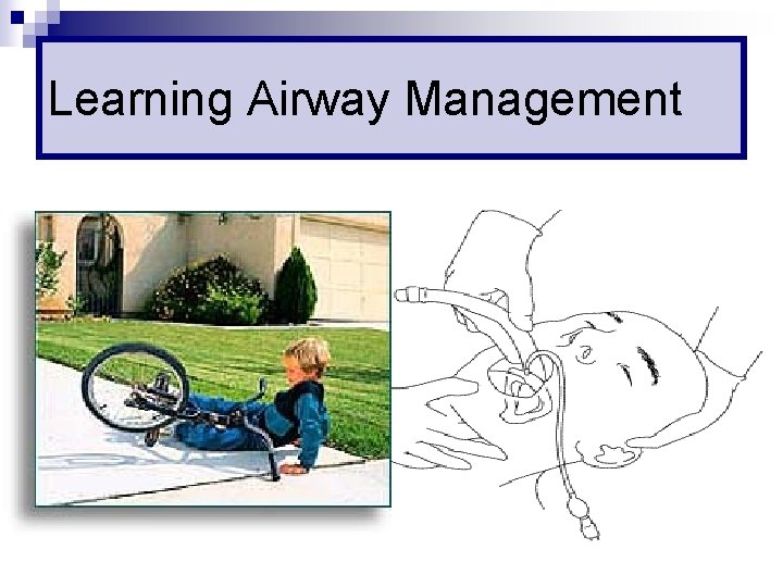 Learning Airway Management 