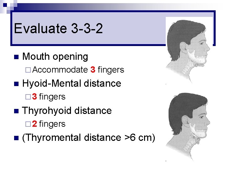 Evaluate 3 -3 -2 n Mouth opening ¨ Accommodate n Hyoid-Mental distance ¨ 3