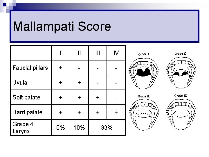 Mallampati Score I II IV Faucial pillars + - - - Uvula + +