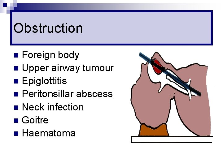 Obstruction Foreign body n Upper airway tumour n Epiglottitis n Peritonsillar abscess n Neck