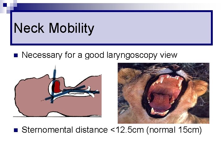 Neck Mobility n Necessary for a good laryngoscopy view n Sternomental distance <12. 5