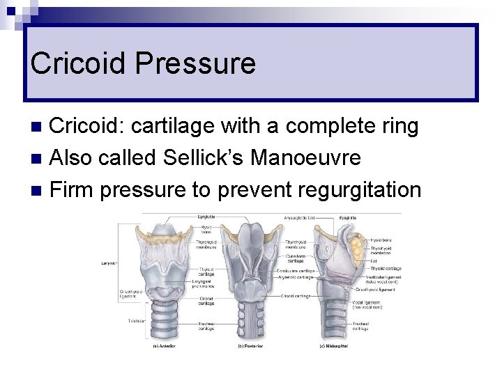 Cricoid Pressure Cricoid: cartilage with a complete ring n Also called Sellick’s Manoeuvre n