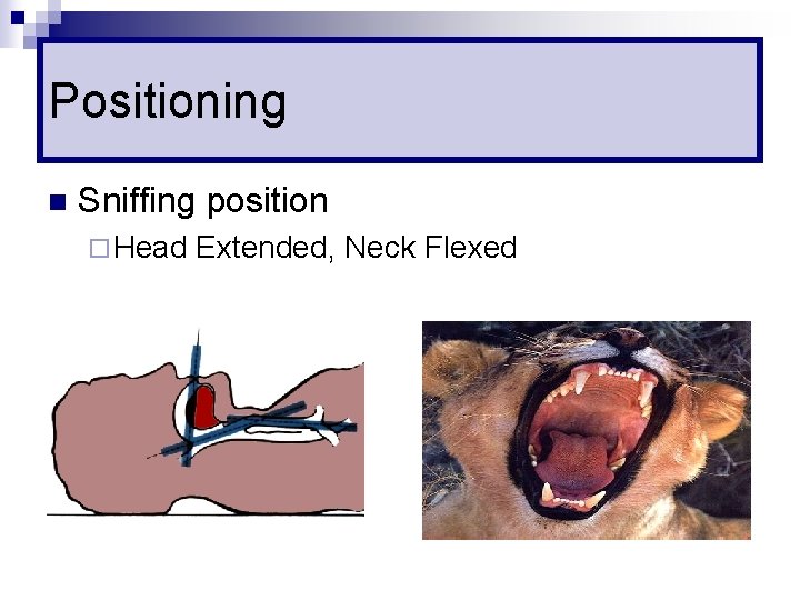 Positioning n Sniffing position ¨ Head Extended, Neck Flexed 