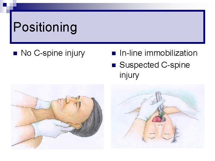Positioning n No C-spine injury n n In-line immobilization Suspected C-spine injury 