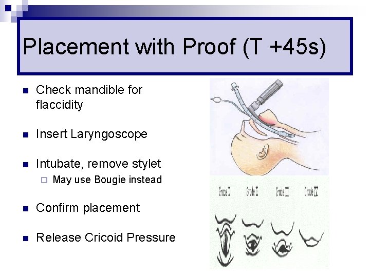 Placement with Proof (T +45 s) n Check mandible for flaccidity n Insert Laryngoscope