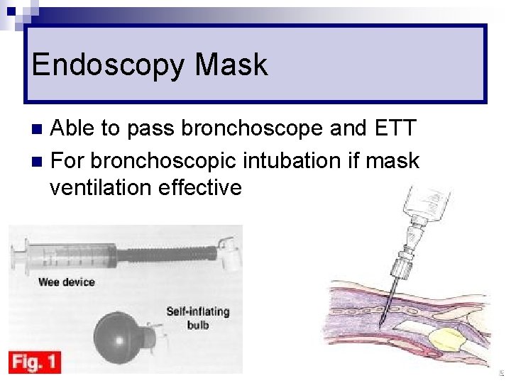 Endoscopy Mask Able to pass bronchoscope and ETT n For bronchoscopic intubation if mask