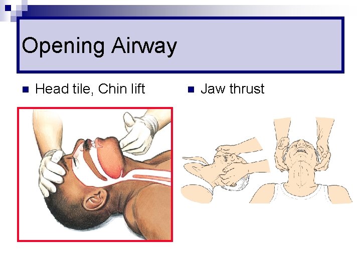 Opening Airway n Head tile, Chin lift n Jaw thrust 