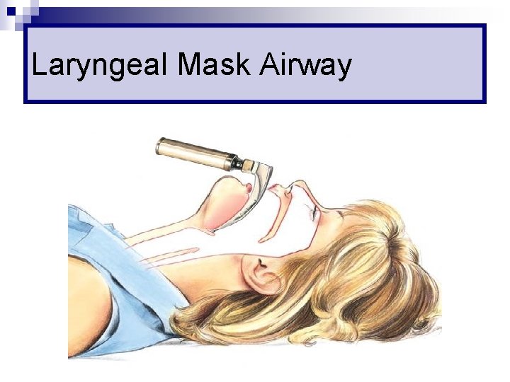 Laryngeal Mask Airway 