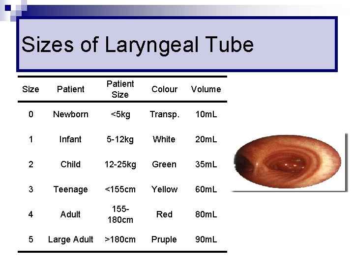 Sizes of Laryngeal Tube Size Patient Size Colour Volume 0 Newborn <5 kg Transp.