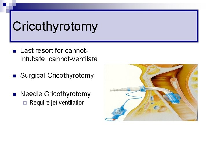 Cricothyrotomy n Last resort for cannotintubate, cannot-ventilate n Surgical Cricothyrotomy n Needle Cricothyrotomy ¨