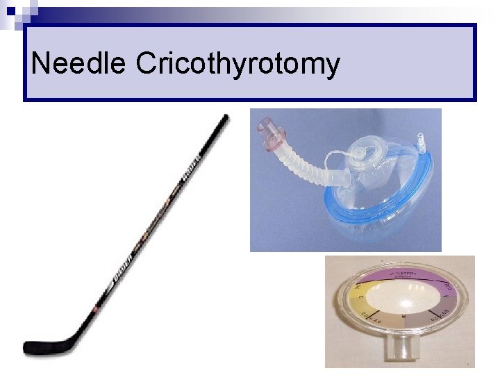 Needle Cricothyrotomy 