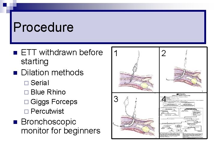 Procedure n n ETT withdrawn before starting Dilation methods 1 2 3 4 ¨