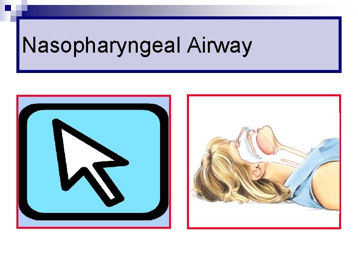 Nasopharyngeal Airway 