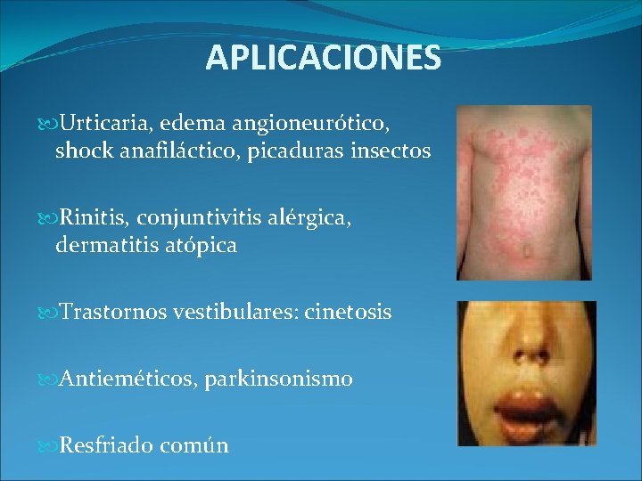 APLICACIONES Urticaria, edema angioneurótico, shock anafiláctico, picaduras insectos Rinitis, conjuntivitis alérgica, dermatitis atópica Trastornos