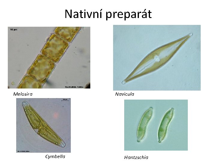 Nativní preparát Melosira Navicula Cymbella Hantzschia 