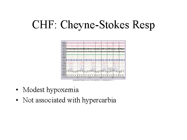 CHF: Cheyne-Stokes Resp • Modest hypoxemia • Not associated with hypercarbia 
