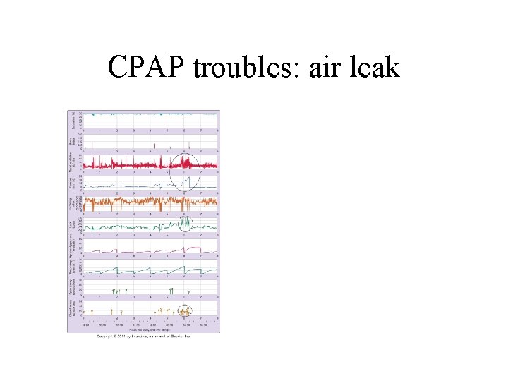 CPAP troubles: air leak 