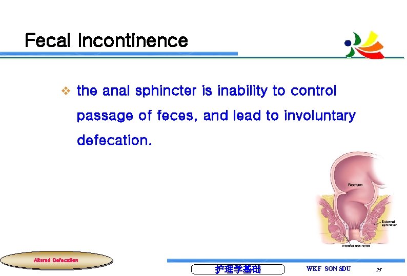 Fecal Incontinence v the anal sphincter is inability to control passage of feces, and