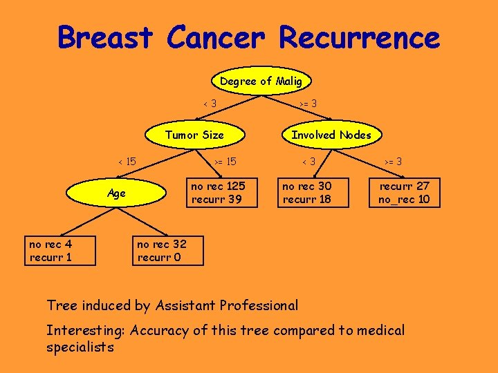 Breast Cancer Recurrence Degree of Malig <3 Tumor Size < 15 Involved Nodes >= Breast Cancer Recurrence Degree of Malig <3 Tumor Size < 15 Involved Nodes >=