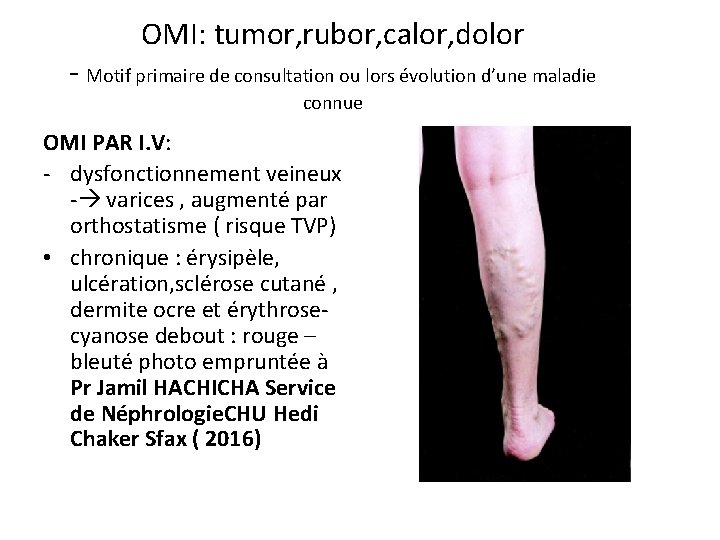 OMI: tumor, rubor, calor, dolor - Motif primaire de consultation ou lors évolution d’une
