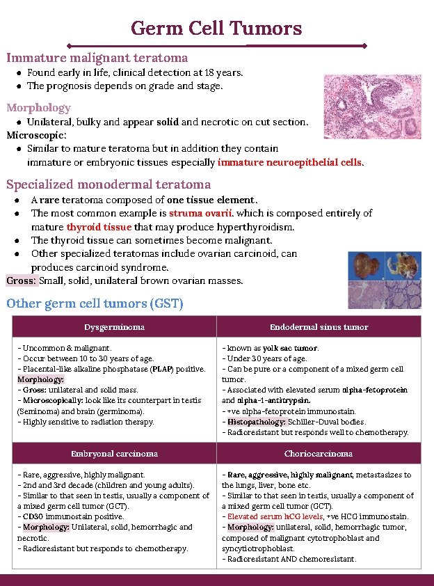 Germ Cell Tumors Immature malignant teratoma ● Found early in life, clinical detection at