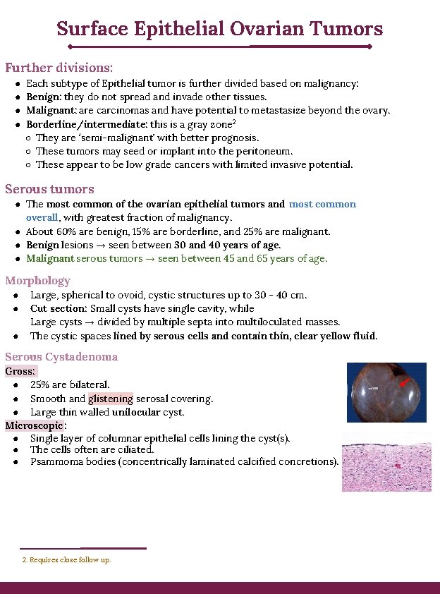 Surface Epithelial Ovarian Tumors Further divisions: ● ● Each subtype of Epithelial tumor is