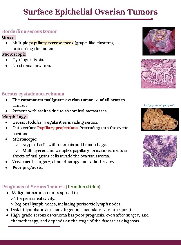 Surface Epithelial Ovarian Tumors Borderline serous tumor Gross: ● Multiple papillary excrescences (grape-like clusters),