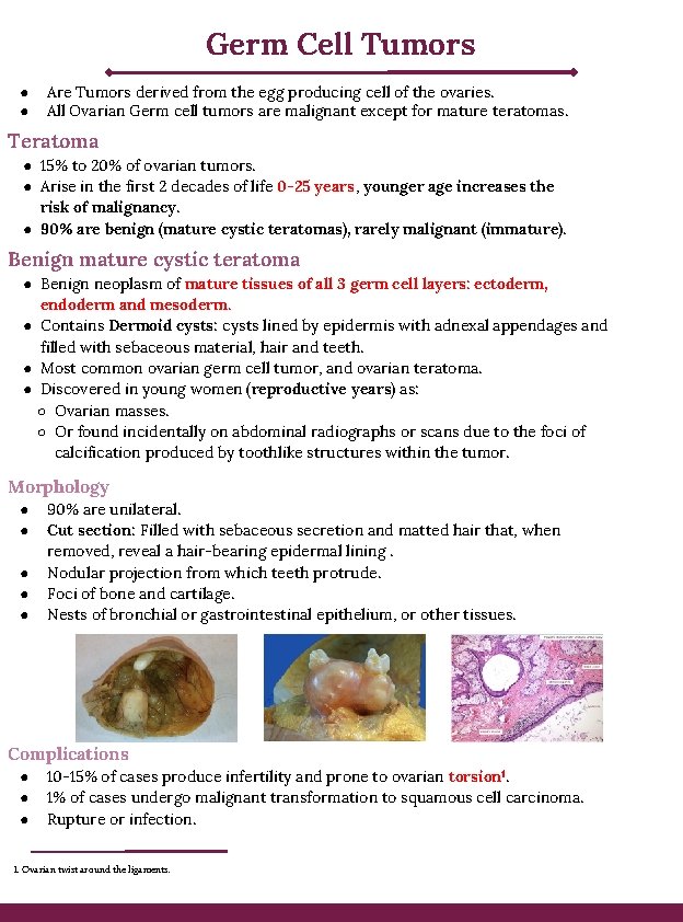 Germ Cell Tumors ● ● Are Tumors derived from the egg producing cell of Germ Cell Tumors ● ● Are Tumors derived from the egg producing cell of