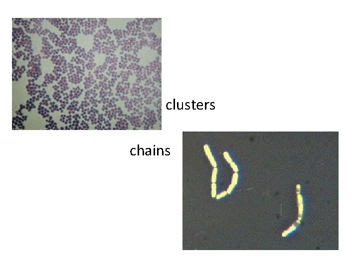  clusters chains 