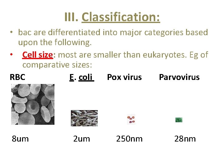 III. Classification: • bac are differentiated into major categories based upon the following. •