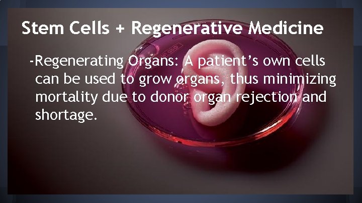 Stem Cells + Regenerative Medicine -Regenerating Organs: A patient’s own cells can be used