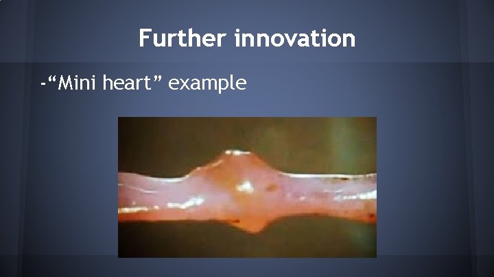 Further innovation -“Mini heart” example 