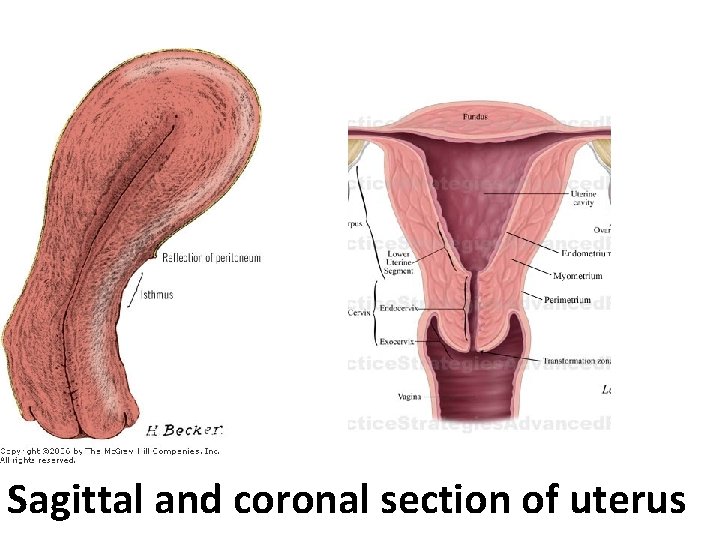 Sagittal and coronal section of uterus 