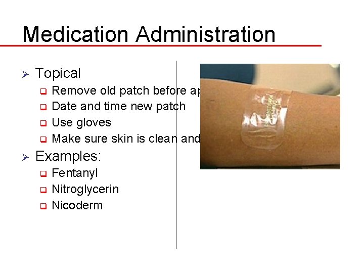 Medication Administration Ø Topical Remove old patch before applying new q Date and time